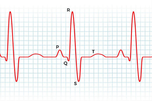 Heartrate