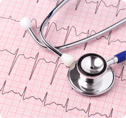Stethoscope on a Paper of Heartbeat Recordings