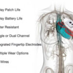 A TelePatch monitor edited over an anatomical drawing of a human torso's cardiovascular system