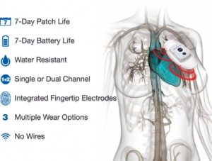 A TelePatch monitor edited over an anatomical drawing of a human torso's cardiovascular system