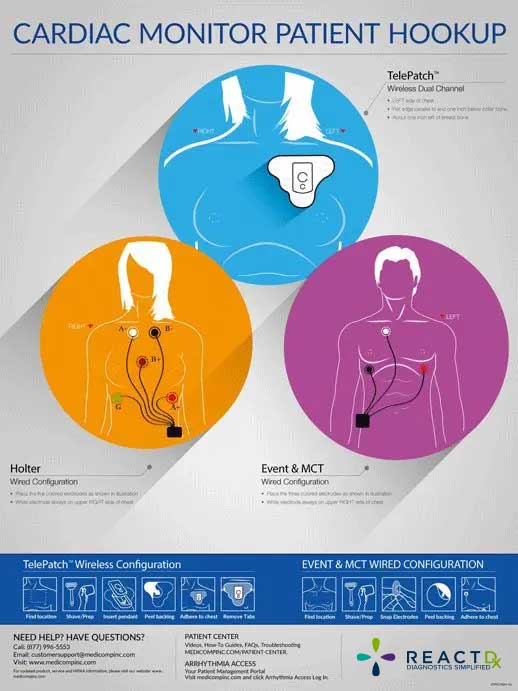 Cardiac-Monitor-Patient-Hook-Up-Poster